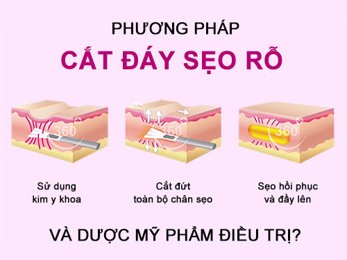 Nguy Cơ Của Phương Pháp Cắt Đáy Sẹo Và Dược Mỹ Phẩm Thay Thế?