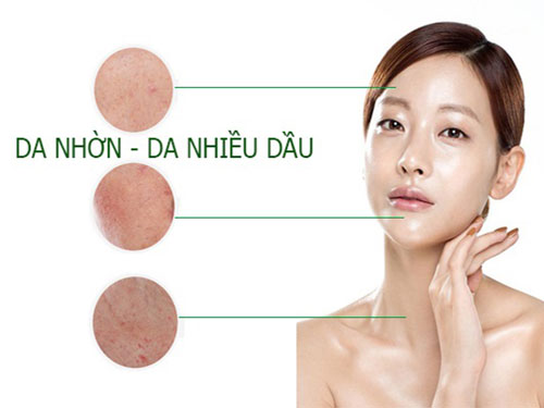 Da Dầu Là Gì? Và Cách Chăm Sóc Da Dầu Để Tránh Bị Mụn?